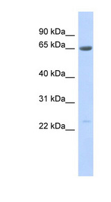 SSX7 antibody LS-C111319 Western blot of Fetal Pancreas lysate.