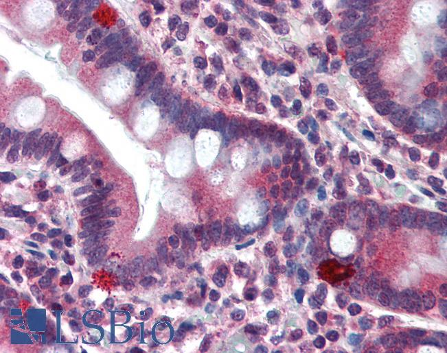 Anti-ST13 / HIP antibody IHC of human small intestine. Immunohistochemistry of formalin-fixed, paraffin-embedded tissue after heat-induced antigen retrieval. Antibody LS-B3054 concentration 10 ug/ml.