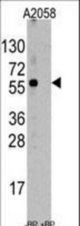 Western blot of anti-ST13 Antibody pre-incubated with and without blocking peptide (BP6247a) in A2058 cell line lysate. ST13(arrow) was detected using the purified antibody.