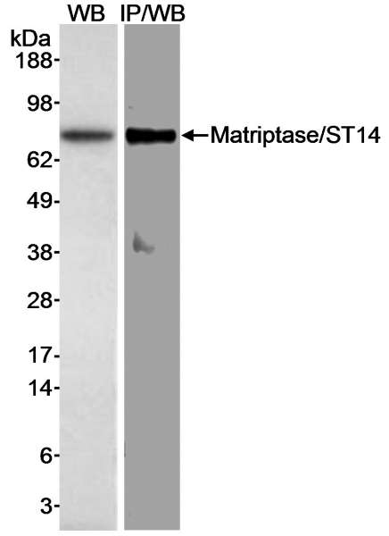 Detection of human Matriptase/ST14 by Western Blot and Immunoprecipitation. Samples: Whole cell lysate (30 ug for WB; 500 ug for IP/WB) from MCF7 cells. Antibody: Affinity purified rabbit anti-Matriptase/ST14 antibody used at 1 ug/ml for WB and at 10 ug/mg lysate for IP. Detection: Chemiluminescence with exposure times of less than 15 min.