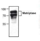 Western blot of ST14 / Matriptase antibody LS-C146994.