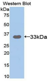 Western blot of recombinant ST14 / Matriptase.