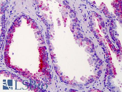 Anti-ST14 / Matriptase antibody IHC of human prostate. Immunohistochemistry of formalin-fixed, paraffin-embedded tissue after heat-induced antigen retrieval. Antibody LS-B4906 concentration 10 ug/ml.