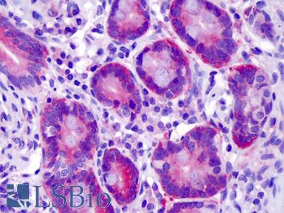Anti-ST14 / Matriptase antibody IHC of human small intestine. Immunohistochemistry of formalin-fixed, paraffin-embedded tissue after heat-induced antigen retrieval. Antibody LS-B4906 concentration 10 ug/ml.