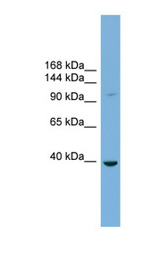 ST14 / Matriptase antibody LS-C116349 Western blot of THP-1 cell lysate.