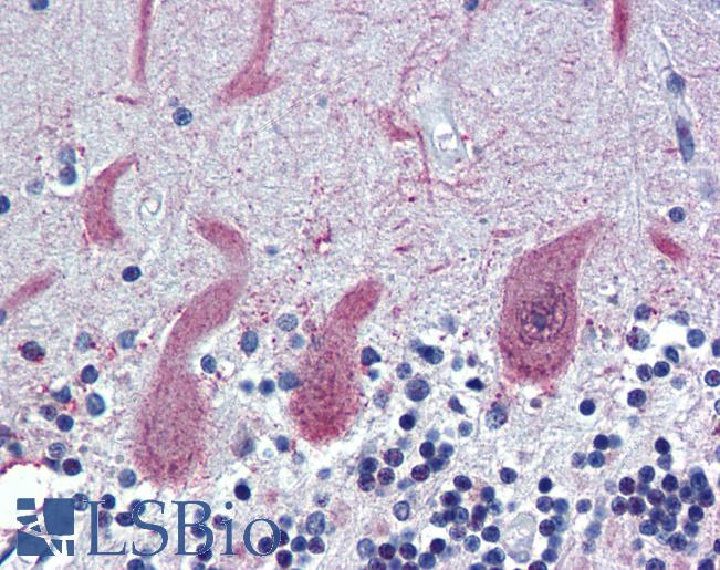 Anti-ST18 antibody IHC of human brain, cerebellum. Immunohistochemistry of formalin-fixed, paraffin-embedded tissue after heat-induced antigen retrieval. Antibody LS-B3507 concentration 5 ug/ml.
