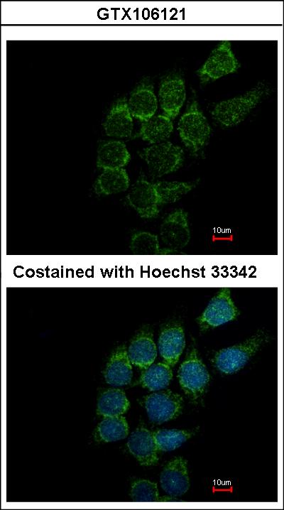 Immunofluorescence of methanol-fixed Hep3B using SIAT4A antibody at 1:500 dilution.