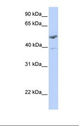 Placenta lysate. Antibody concentration: 1.0 ug/ml. Gel concentration: 12%.