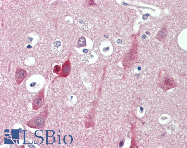 Anti-ST3GAL2 antibody IHC staining of human brain, cortex. Immunohistochemistry of formalin-fixed, paraffin-embedded tissue after heat-induced antigen retrieval. Antibody LS-B11026 concentration 10 ug/ml.