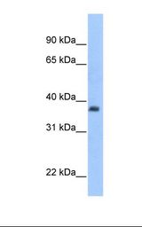 Fetal heart cell lysate. Antibody concentration: 1.0 ug/ml. Gel concentration: 12%.