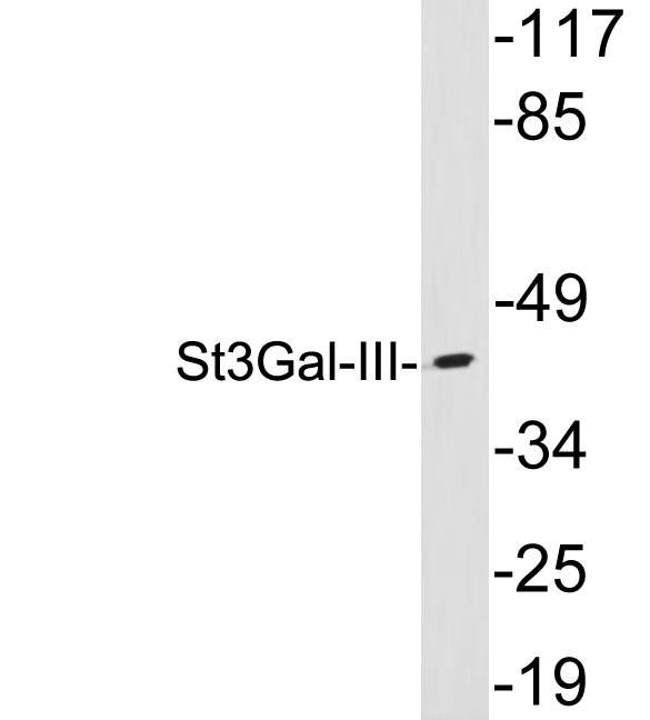 Western blot of extracts from liver, using St3Gal-III antibody.
