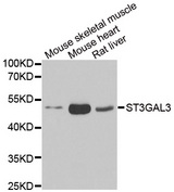 Western blot analysis of extracts of various cell lines, using ST3GAL3 antibody.