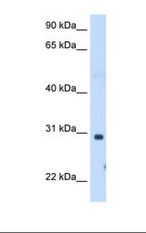 Fetal muscle cell lysate. Antibody concentration: 1.25 ug/ml. Gel concentration: 12%.