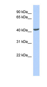 ST3GAL4 antibody LS-C102240 Western blot of 721_B cell lysate.