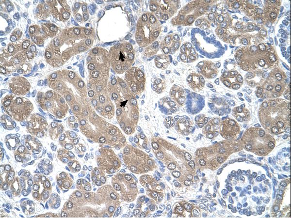 ST3GAL5 antibody LS-C80886 was used in IHC to stain formalin-fixed, paraffin-embedded human kidney.