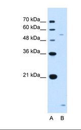 Lane A: Marker. Lane B: Jurkat cell lysate. Antibody concentration: 1.25 ug/ml. Gel concentration: 12%.