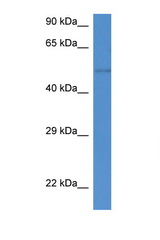 ST6GAL2 antibody LS-C135240 Western blot of Small Intestine lysate. Antibody concentration 1 ug/ml.