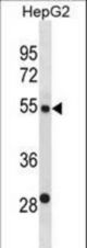 ST6GAL2 Antibody western blot of HepG2 cell line lysates (35 ug/lane). The ST6GAL2 antibody detected the ST6GAL2 protein (arrow).