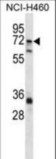 ST6GALNAC1 Antibody western blot of NCI-H460 cell line lysates (35 ug/lane). The ST6GALNAC1 antibody detected the ST6GALNAC1 protein (arrow).