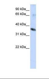 HepG2 cell lysate. Antibody concentration: 1.0 ug/ml. Gel concentration: 12%.