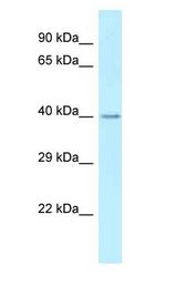 ST6GALNAC2 antibody Western Blot of Rat Liver.