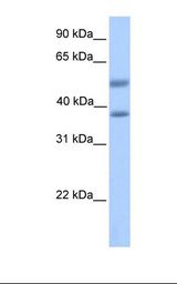 Fetal heart lysate. Antibody concentration: 1.0 ug/ml. Gel concentration: 12%.