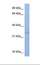 HepG2 cell lysate. Antibody concentration: 1.0 ug/ml. Gel concentration: 12%.