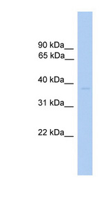 ST6GALNAC6 antibody LS-C117111 Western blot of Fetal Heart lysate.