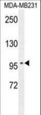 ST7 Antibody western blot of MDA-MB231 cell line lysates (35 ug/lane). The ST7 antibody detected the ST7 protein (arrow).