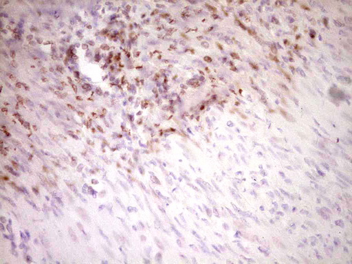IHC of paraffin-embedded Human endometrium tissue using anti-STAB2 mouse monoclonal antibody. (Heat-induced epitope retrieval by 1 mM EDTA in 10mM Tris, pH8.5, 120°C for 3min).