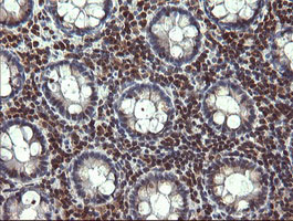IHC of paraffin-embedded Human colon tissue using anti-TRIM22 mouse monoclonal antibody. (Heat-induced epitope retrieval by 10mM citric buffer, pH6.0, 120°C for 3min).