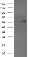 HEK293T cells were transfected with the pCMV6-ENTRY control (Left lane) or pCMV6-ENTRY TRIM22 (Right lane) cDNA for 48 hrs and lysed. Equivalent amounts of cell lysates (5 ug per lane) were separated by SDS-PAGE and immunoblotted with anti-TRIM22.
