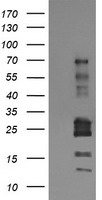 E.coli lysate (5 ug, left lane) and E.coli lysate expressing human recombinant protein fragment (5 ug, right lane) corresponding to amino acids 61-406 of human TRIM22 (NP_006065) were separated by SDS-PAGE and immunoblotted with anti-TRIM22.