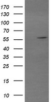 HEK293T cells were transfected with the pCMV6-ENTRY control (Left lane) or pCMV6-ENTRY TRIM22 (Right lane) cDNA for 48 hrs and lysed. Equivalent amounts of cell lysates (5 ug per lane) were separated by SDS-PAGE and immunoblotted with anti-TRIM22.