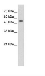 Jurkat Cell Lysate