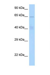 STAM antibody LS-C146066 Western blot of HeLa Cell lysate. Antibody concentration 1 ug/ml.