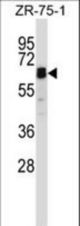 STAM2 Antibody western blot of ZR-75-1 cell line lysates (35 ug/lane). The STAM2 antibody detected the STAM2 protein (arrow).