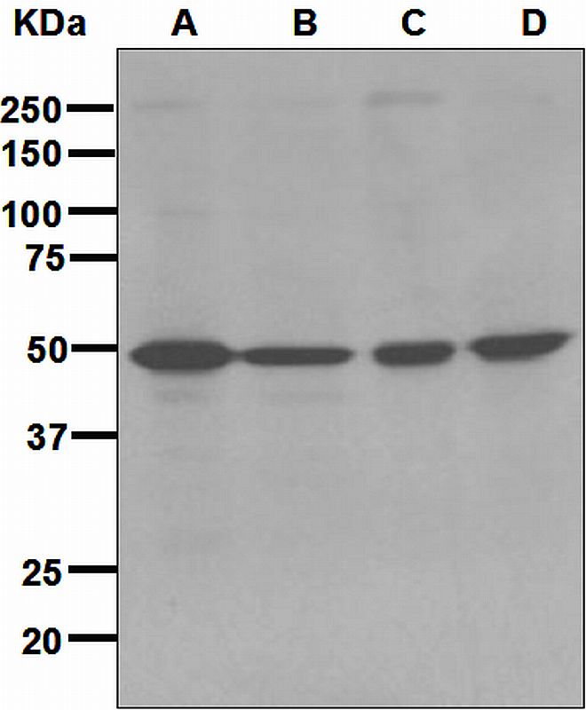 Western blot analysis on (A) Jurkat, (B) HeLa, (C) Raji, and (D) SW480 cell lysates using anti-AMSH antibody.