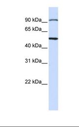 Jurkat cell lysate. Antibody concentration: 1.0 ug/ml. Gel concentration: 12%.