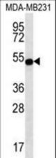 STAP2 Antibody western blot of MDA-MB231 cell line lysates (35 ug/lane). The STAP2 antibody detected the STAP2 protein (arrow).