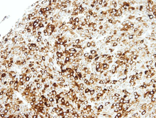 IHC of paraffin-embedded BT483 xenograft using STAP2 antibody at 1:100 dilution.
