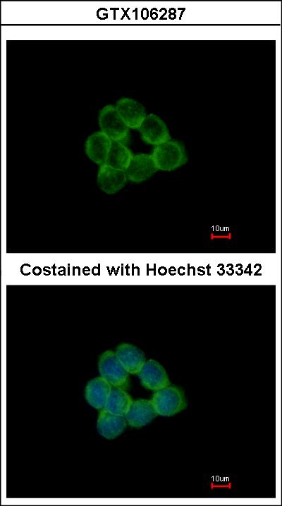 Immunofluorescence of methanol-fixed HCT116 using STAP2 antibody at 1:500 dilution.