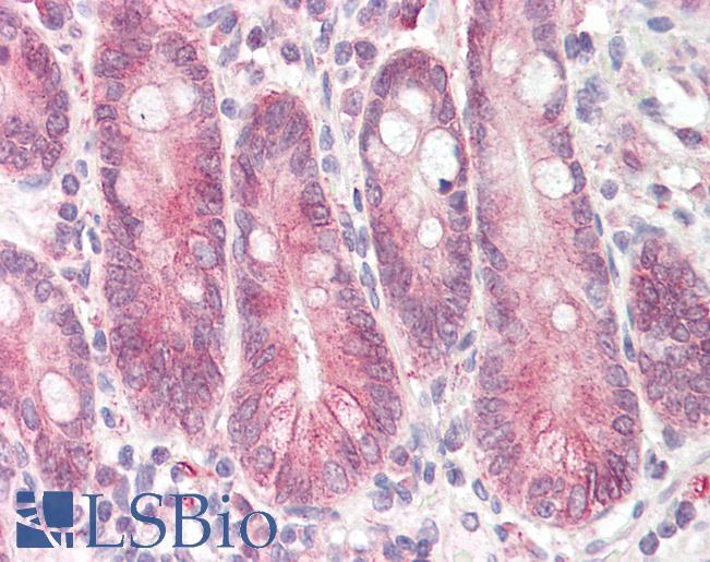 Anti-STAP2 antibody IHC of human small intestine. Immunohistochemistry of formalin-fixed, paraffin-embedded tissue after heat-induced antigen retrieval. Antibody LS-B8288 dilution 3.75 ug/ml.