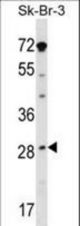 STAR Antibody western blot of SK-BR-3 cell line lysates (35 ug/lane). The STAR antibody detected the STAR protein (arrow).