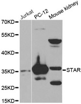 Western blot analysis of extracts of various cell lines, using AKT antibody.
