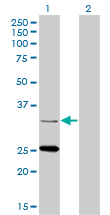 Western Blot analysis of STAR expression in transfected 293T cell line by STAR monoclonal antibody (M01), clone 5F9.Lane 1: STAR transfected lysate(31.9 KDa).Lane 2: Non-transfected lysate.