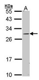 Sample (30 ug of whole cell lysate). A: Molt-4 . 12% SDS PAGE. STAR antibody diluted at 1:1000.