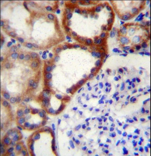 STARD4 Antibody immunohistochemistry of formalin-fixed and paraffin-embedded human kidney tissue followed by peroxidase-conjugated secondary antibody and DAB staining.