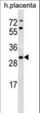 STARD4 Antibody western blot of human placenta tissue lysates (35 ug/lane). The STARD4 antibody detected the STARD4 protein (arrow).