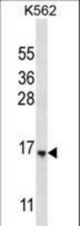 STARD5 Antibody western blot of K562 cell line lysates (35 ug/lane). The STARD5 antibody detected the STARD5 protein (arrow).